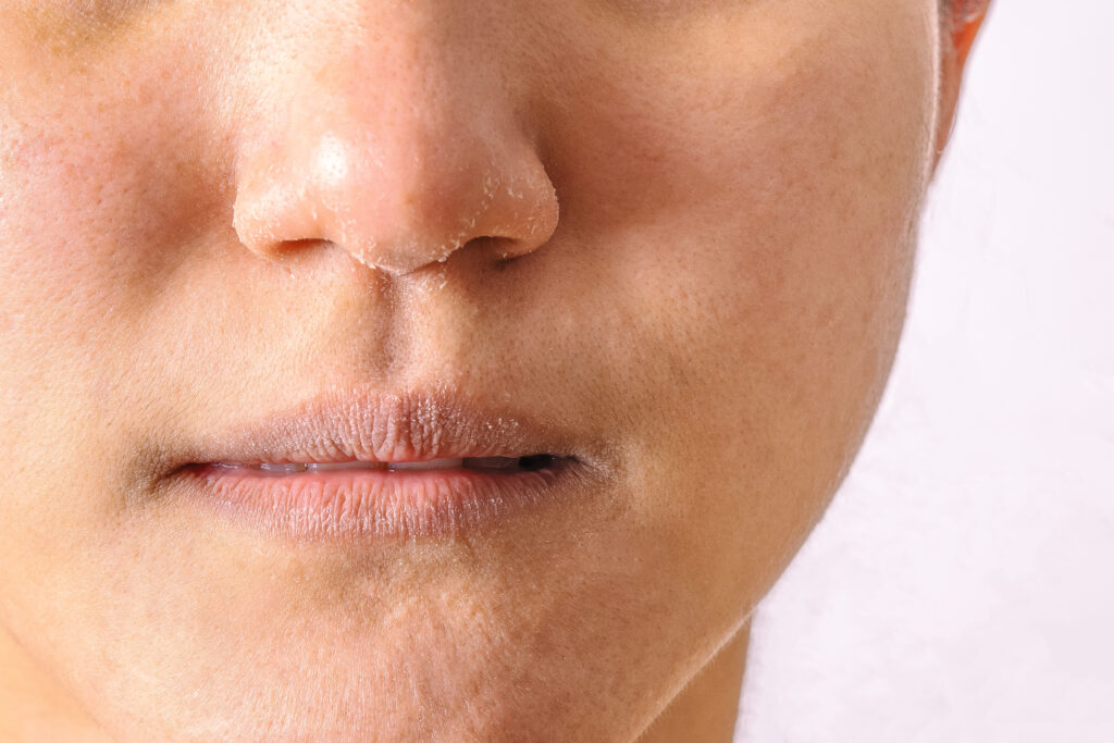 Italian Hydro-Lift HA Skinbooster suits all genders and skin types