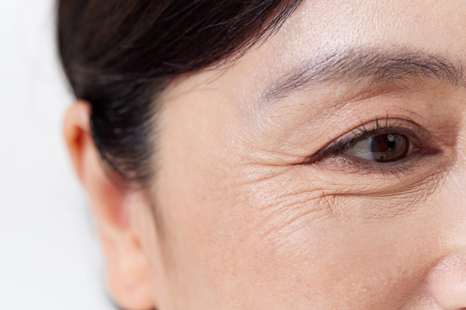 Close-up of fine lines and skin texture around the eye