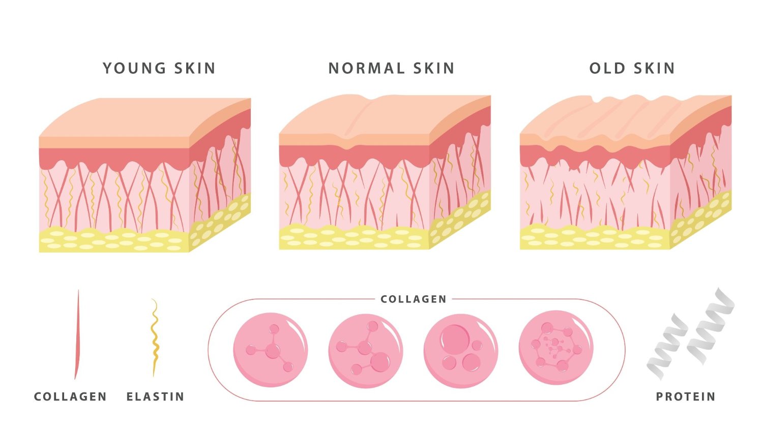 Diagram comparing young, normal and old skin layers with collagen and elastin