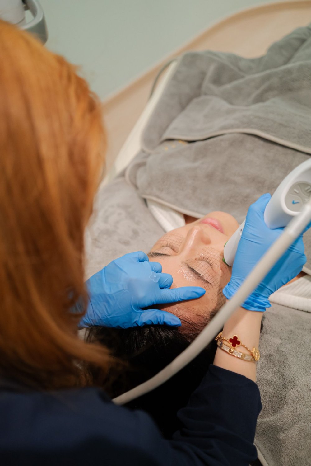 Practitioner performing an RF Lifting (FLX) treatment on a patient's face